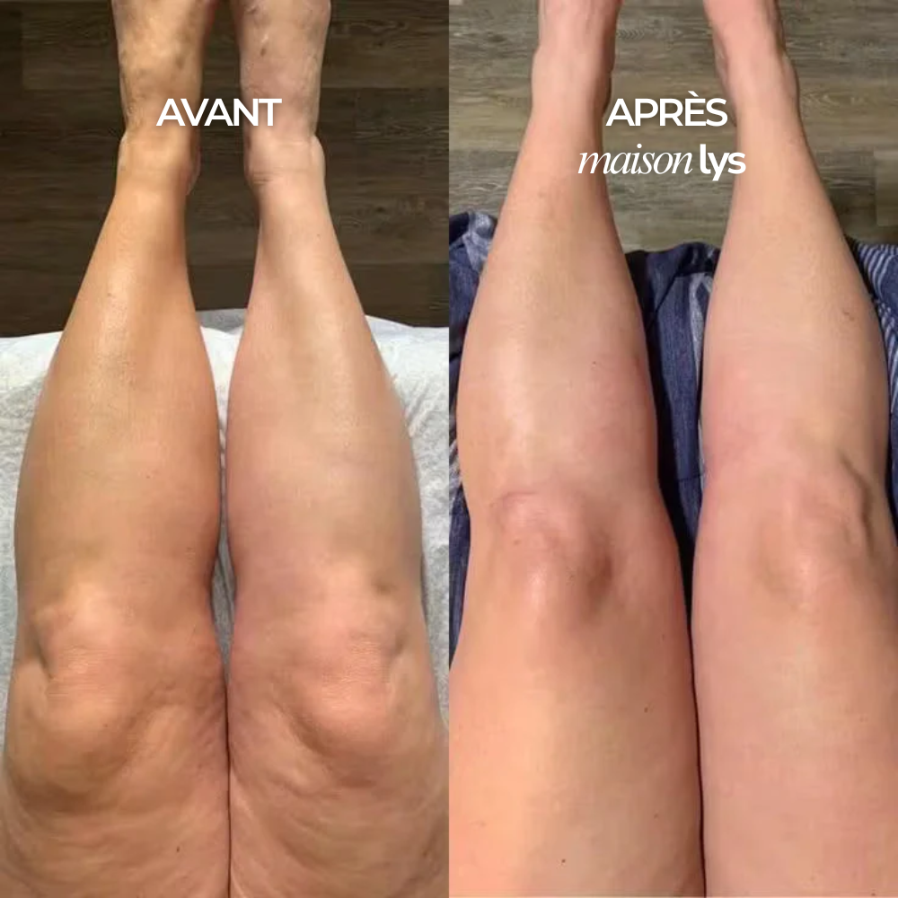 Gouttes Bien-Être Drainage Lymphatique - Ventre