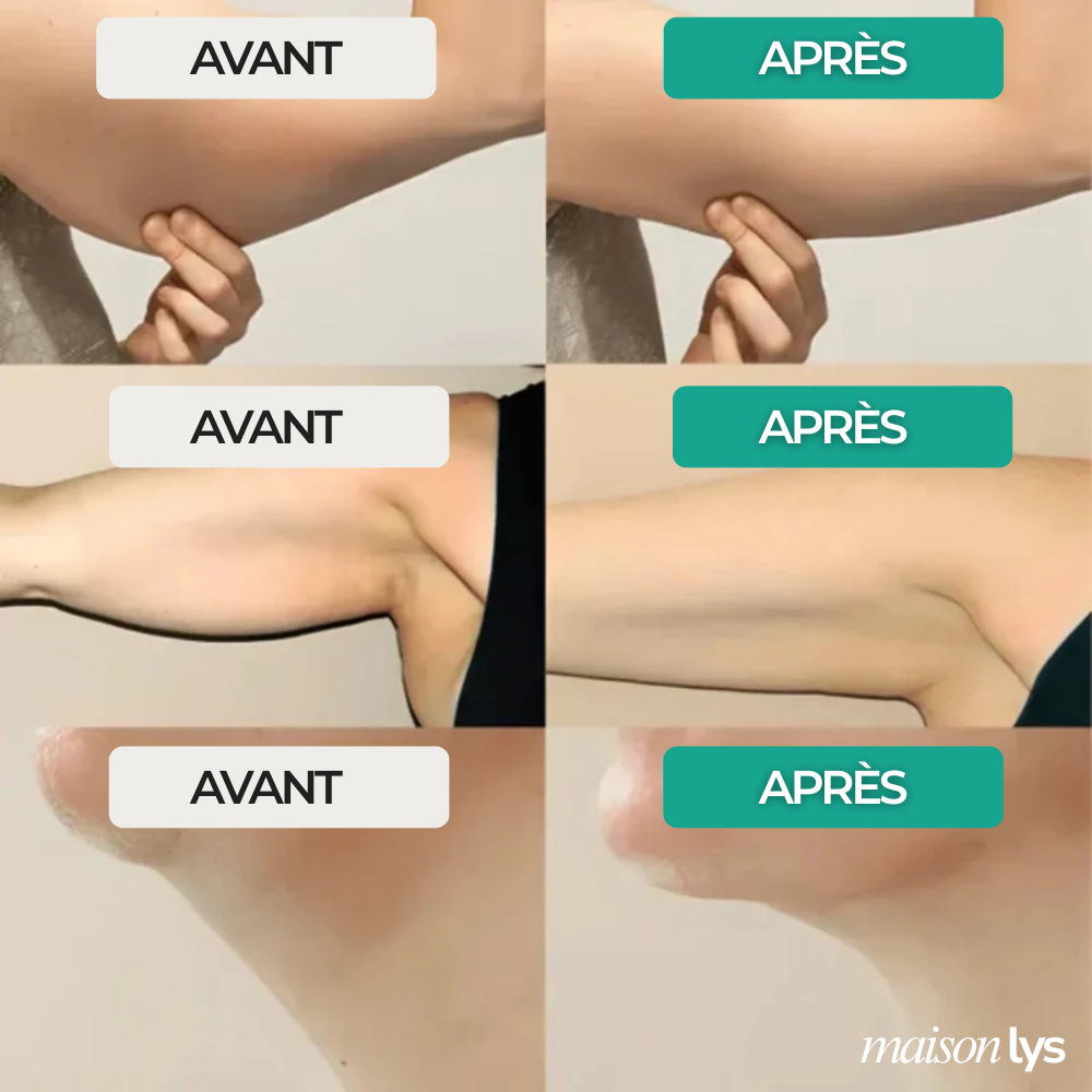 Gouttes Bien-Être Drainage Lymphatique - Cure personnalisé